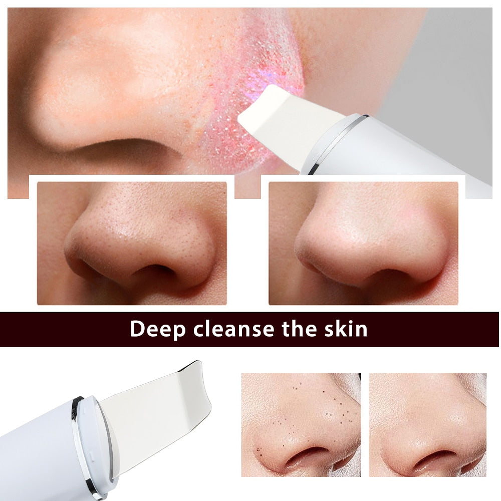 GlowPro Ultrasonic Cleanser